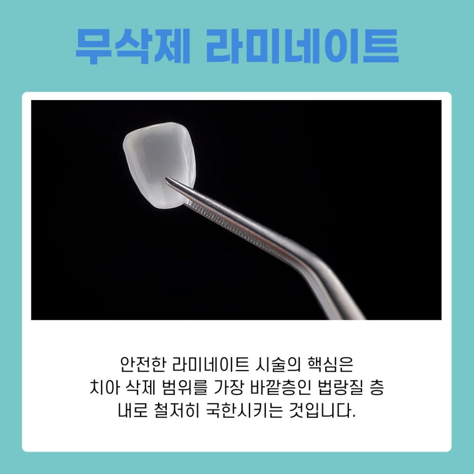 A Procedure Guide from a Gangnam Veneer Dental Clinic image 8