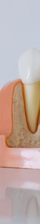 강남 전체임플란트 틀니 생각하고 있다면 관련 이미지 13