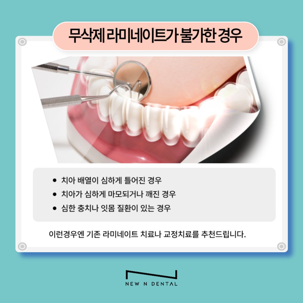 강남역치과 무삭제라미네이트 자신있게 관련 이미지 5