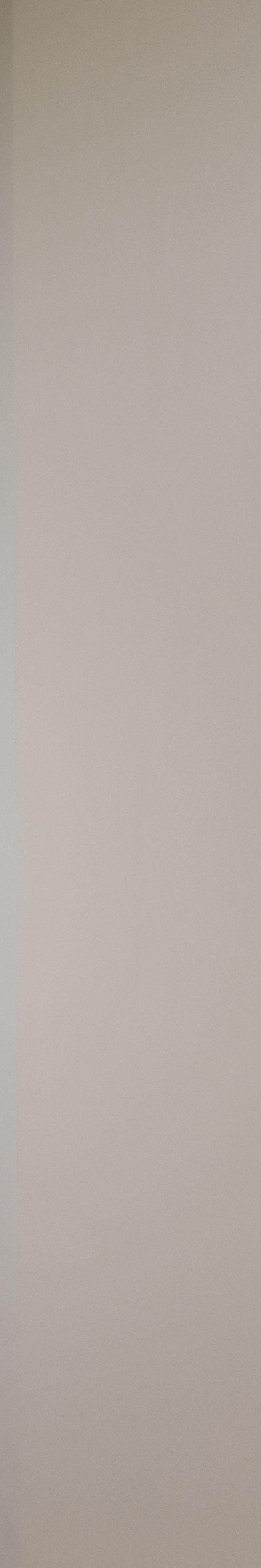 강남역치과추천 치아 삭제 않고 완벽한 미소로 관련 이미지 33