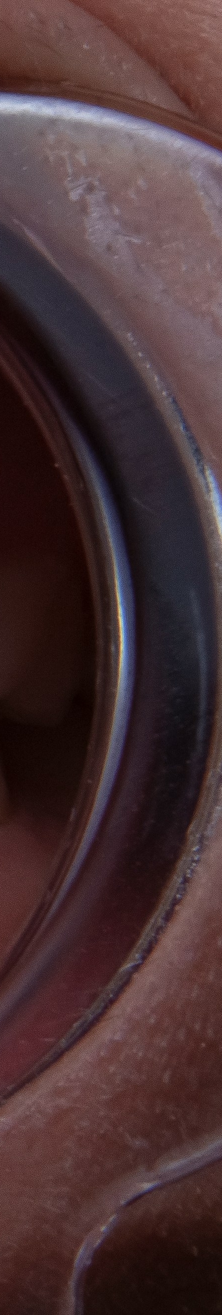 치아 미백 효과와 부작용 체크해야 할 사항 관련 이미지 27