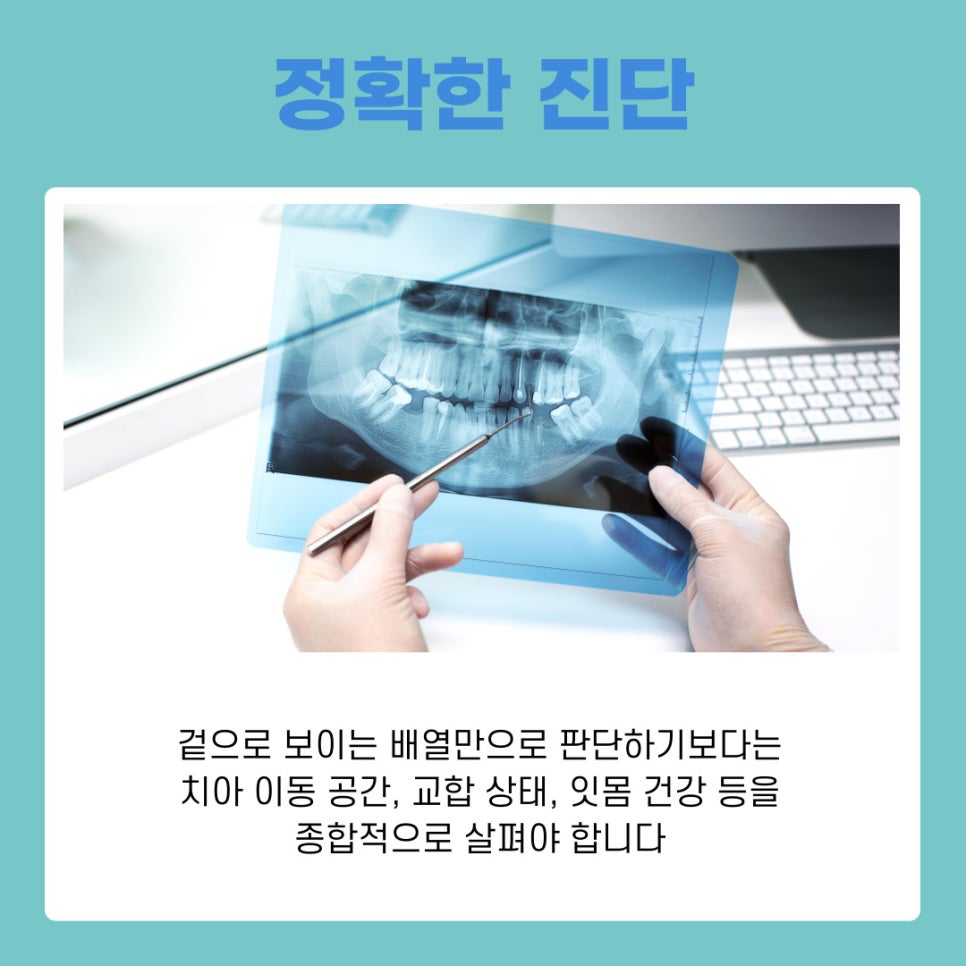 삼성동 교정치과 나에게 맞는 치료법 관련 이미지 3