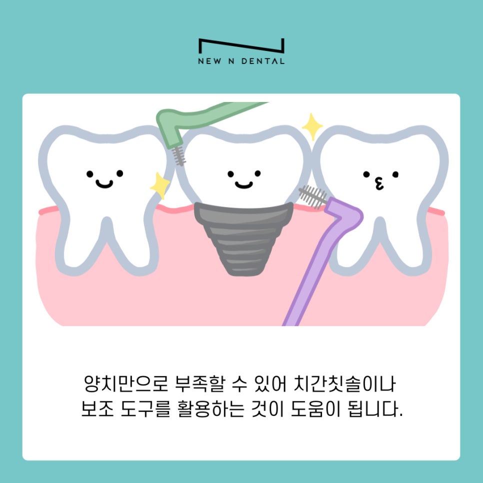 역삼동 임플란트 염증 초기 원인부터 예방법까지 한 번에 보기 관련 이미지 7