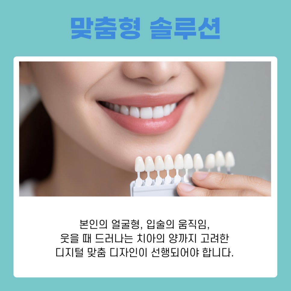 무삭제 라미네이트 자연스럽고 건강한 미소를 위한 완벽 가이드 관련 이미지 4