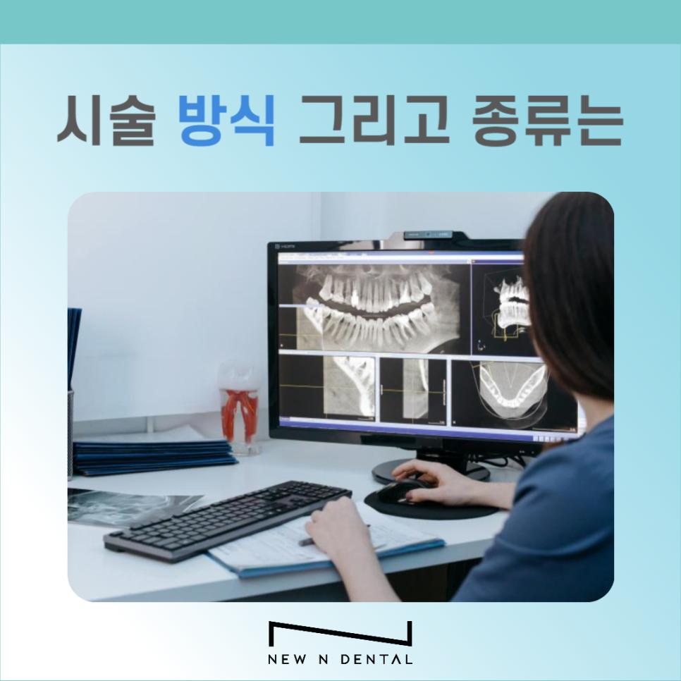 전체임플란트 시술 전 꼭 알아야 할 5가지 관련 이미지 4