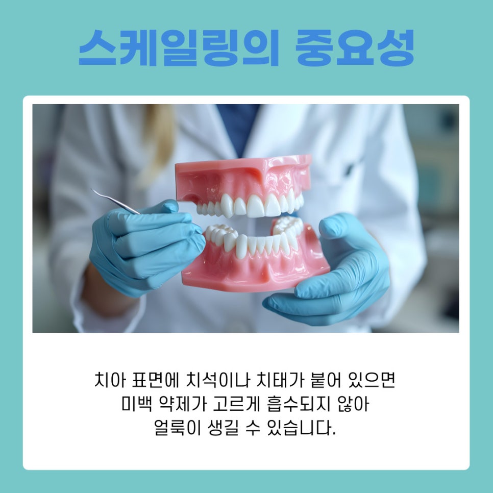 강남역 치아미백 원데이로 완성하는 환한 첫인상의 비밀 관련 이미지 4