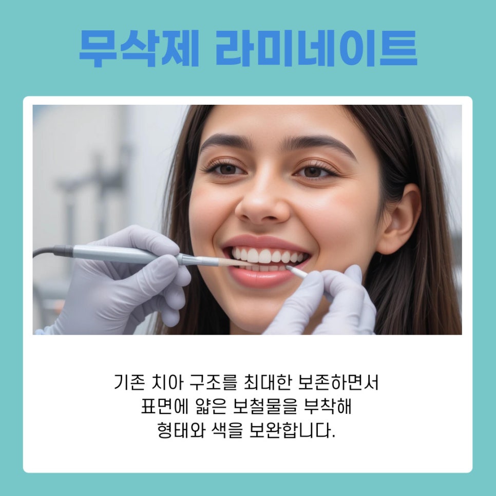 신사동 라미네이트 치과 무삭제 치아성형 자연스러운 변화 관련 이미지 3
