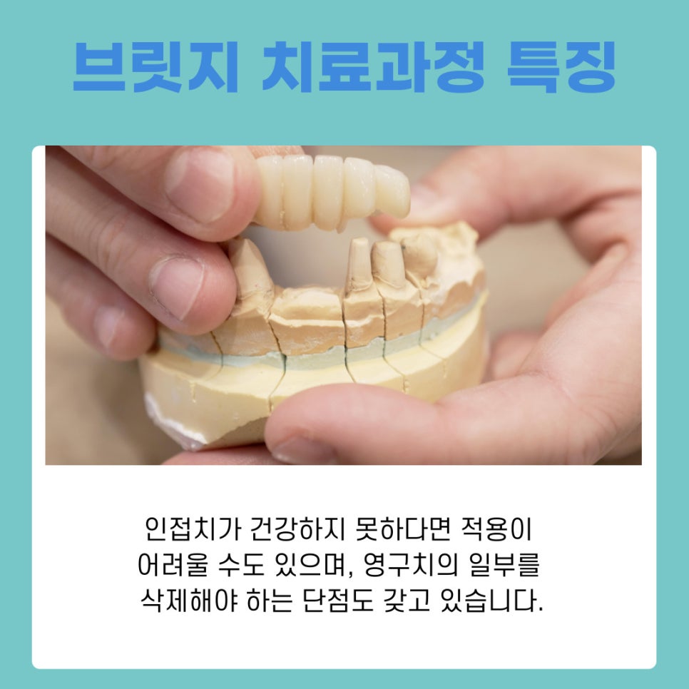 강남역치과 임플란트 시행하는 원인과 고려할 사항 관련 이미지 6