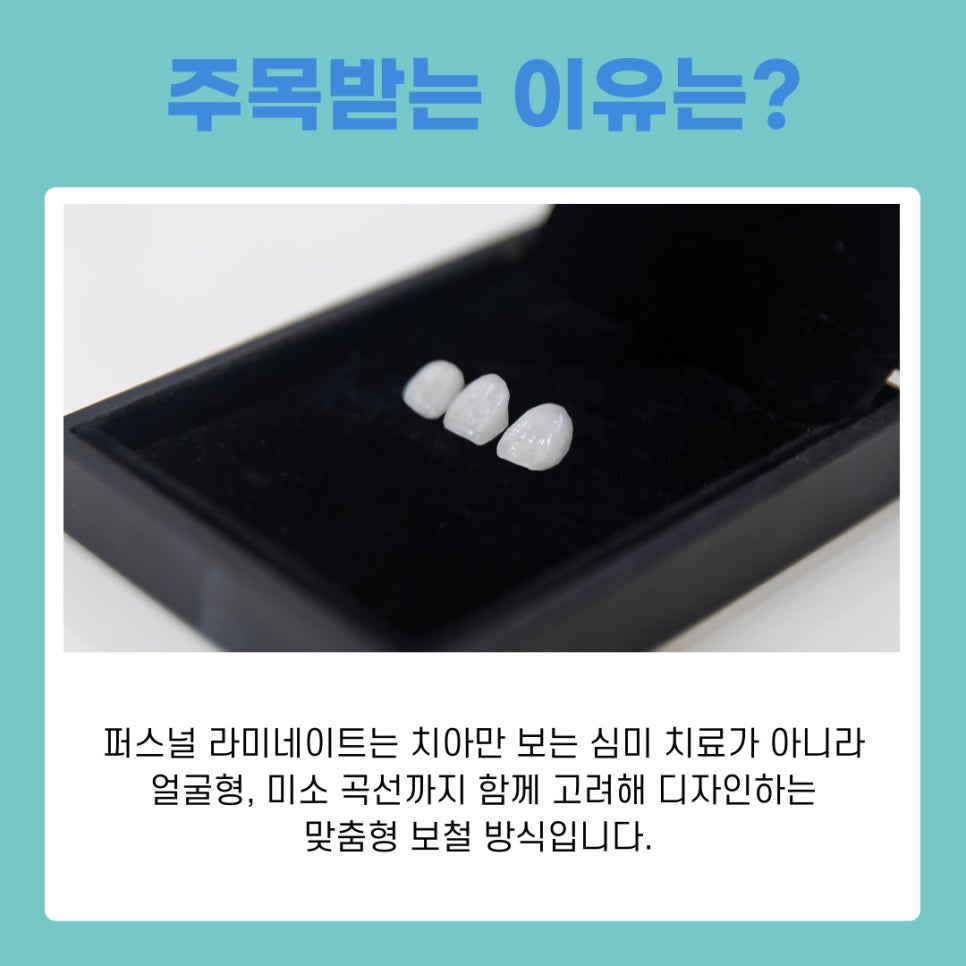 강남 라미네이트 퍼스널 자연스러움의 기준이 달라졌습니다 관련 이미지 8