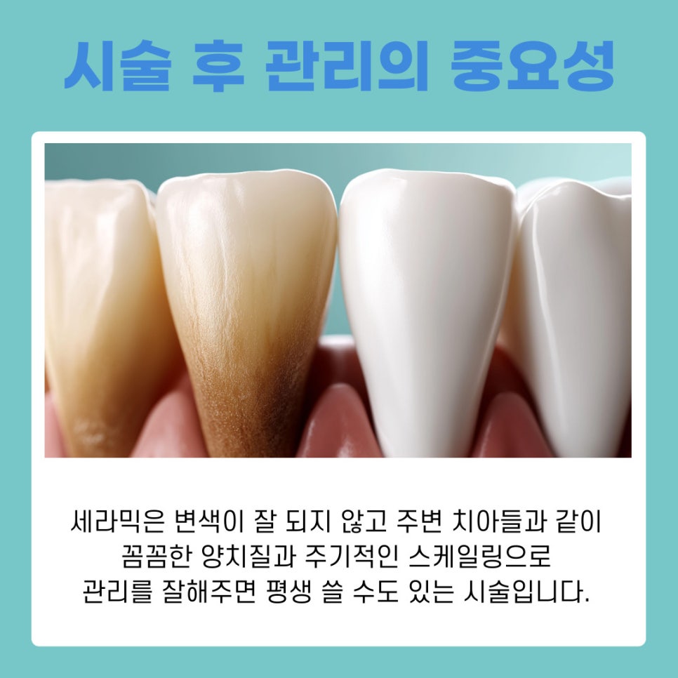강남역치과추천 퍼스널라미 시술후 관리 가이드 관련 이미지 5