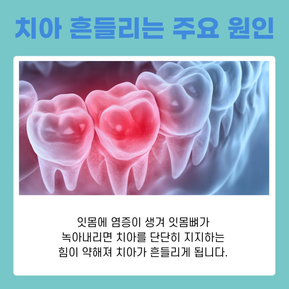 Gangnam Station Dental Clinic: Loose Permanent Teeth, How to Tell Baby Teeth from Permanent Teeth image 8