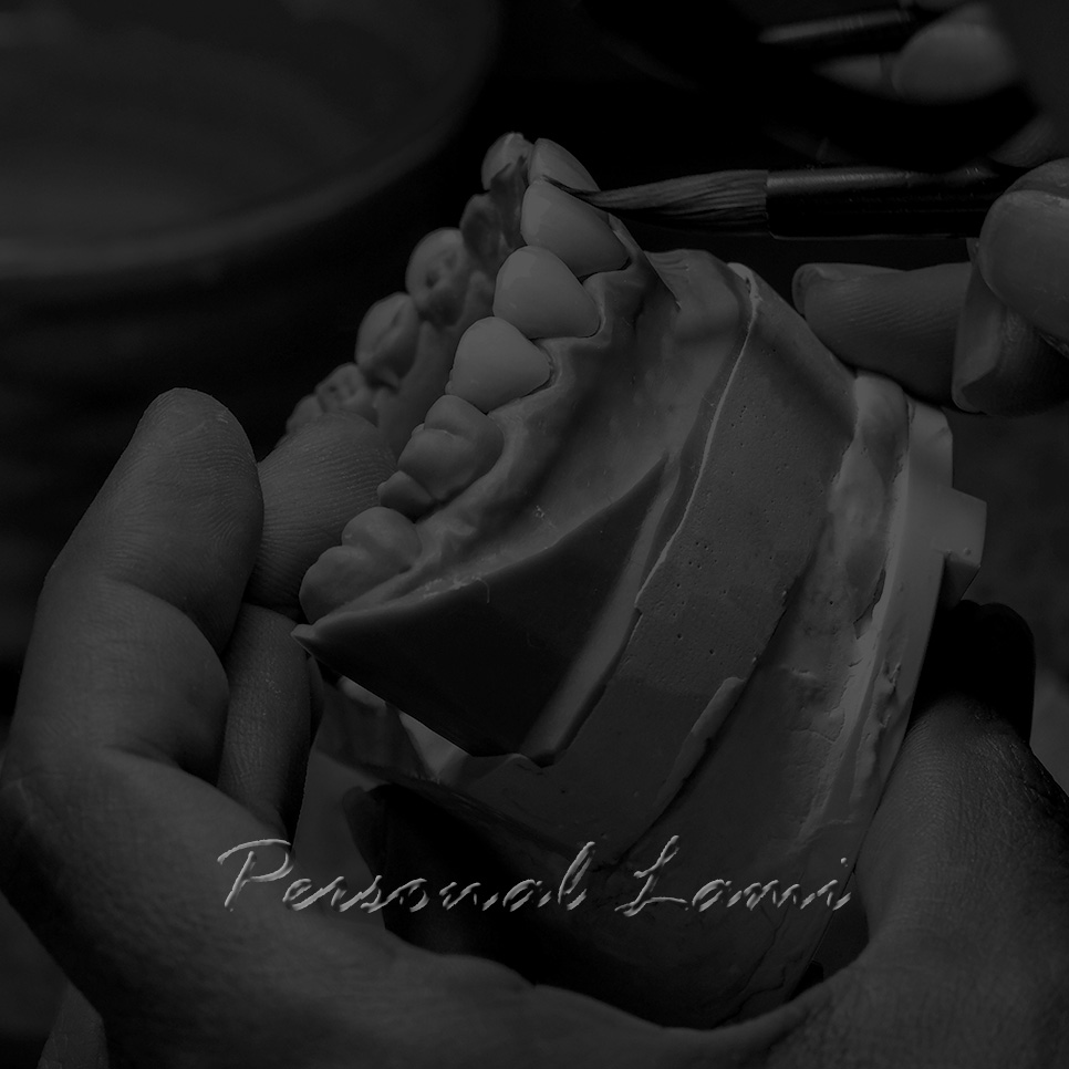 강남역 뉴엔치과 일반 라미네이트와 퍼스널라미의 차이점 관련 이미지 2