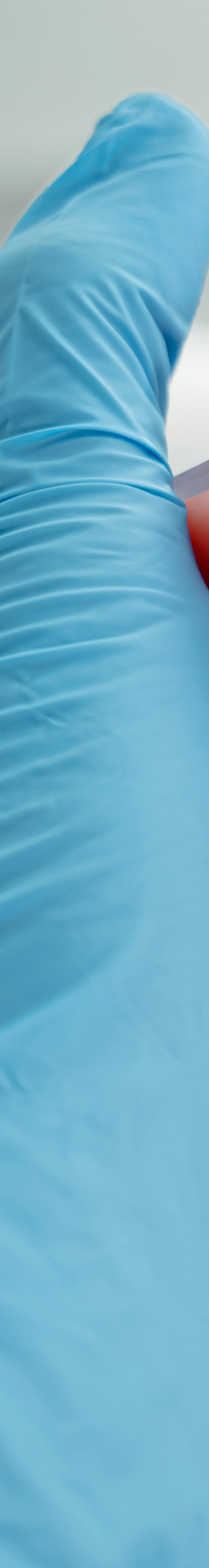 치아교정 후 유지 장치의 필요성 관련 이미지 9