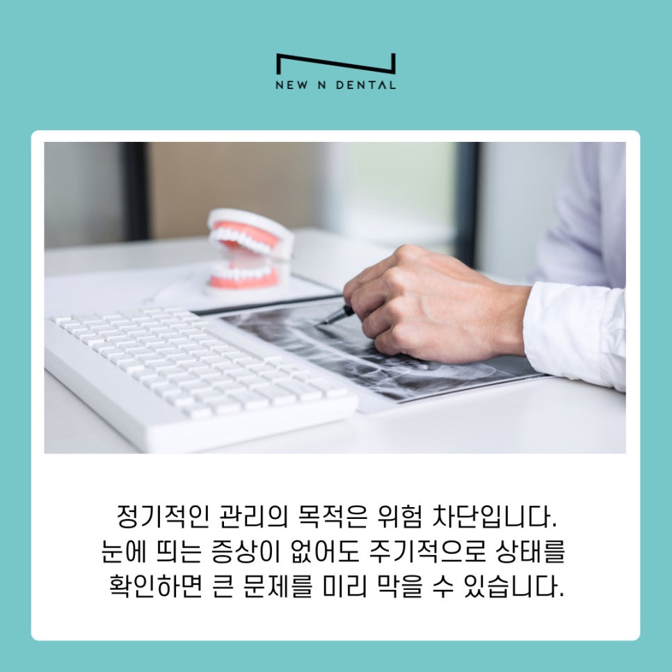 강남 논현동 치과 치석관리 소홀하면 생길 수 있는 위험 관련 이미지 7
