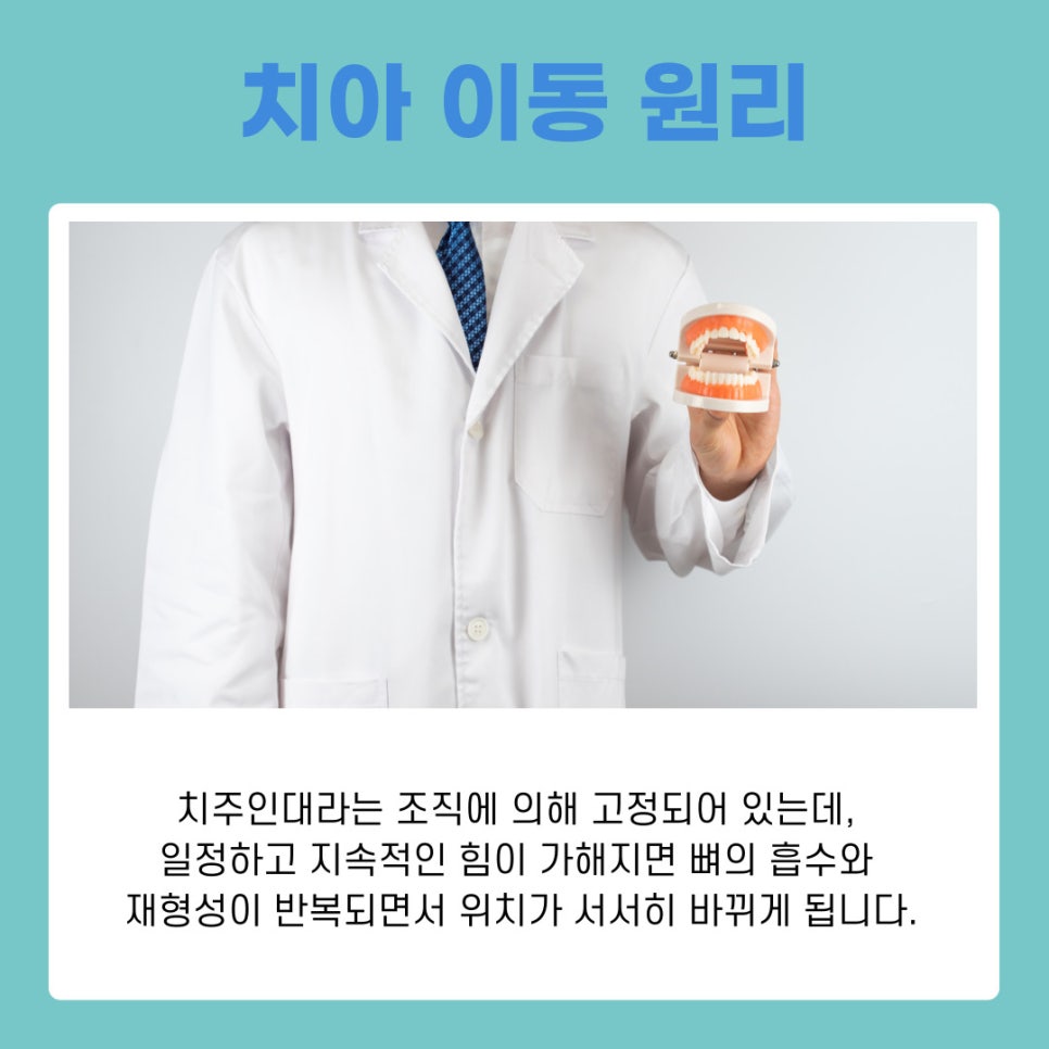 서초구교정치과 치료 전 반드시 알아야 할 기본 정보 정리 관련 이미지 3