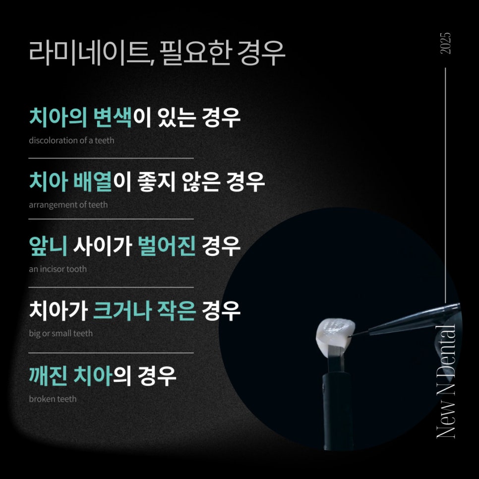 앞니심미치료로 되찾는 자연스러운 스마일 라인 관련 이미지 4