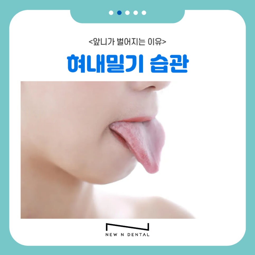 강남역치과 앞니 벌어짐 원인, 치료와 방법 관련 이미지 5