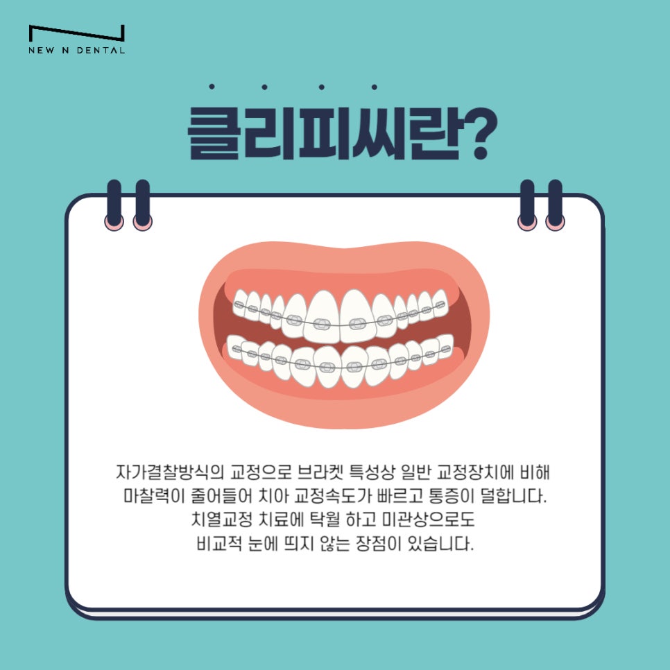 강남 클리피씨 교정기간 짧은 찐후기 관련 이미지 3