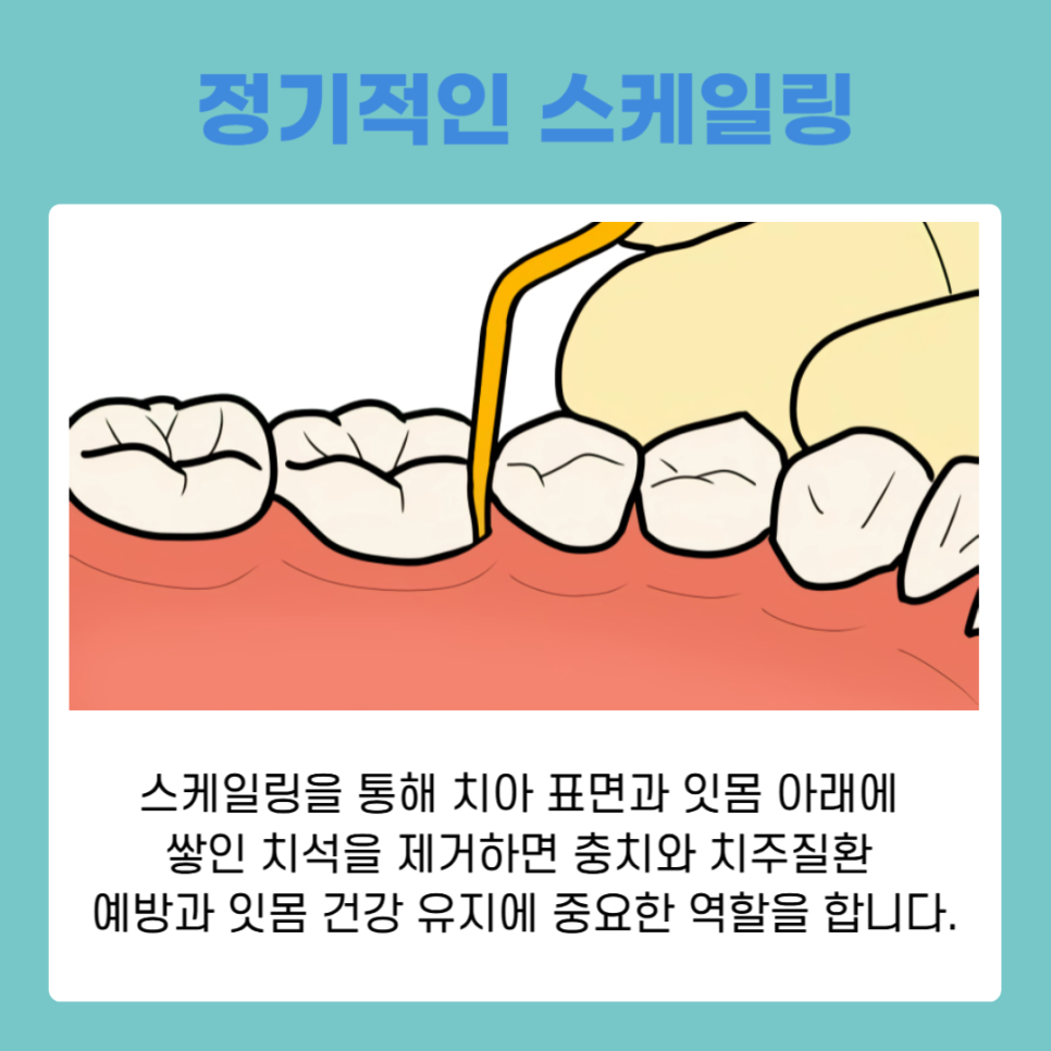 건강한 구강을 위한 치아관리방법, 치실사용순서 제대로 알기 관련 이미지 5