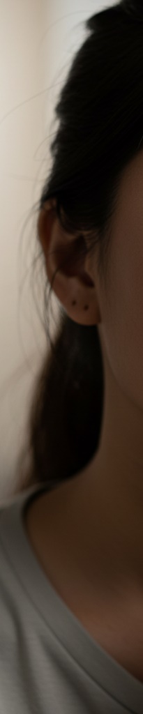 퍼스널라미 적용시키면 좋은 치아는? 관련 이미지 10