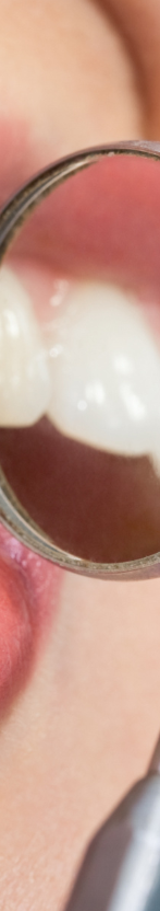 강남 무삭제라미네이트 치아깎지않는 개선방법 관련 이미지 15