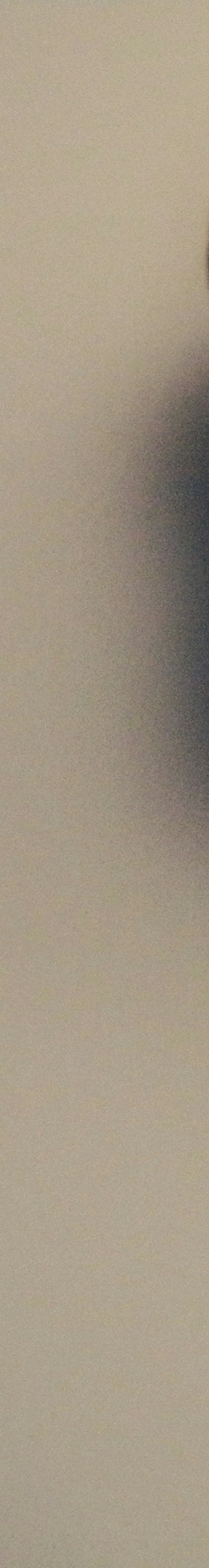 사랑니 발치 전 후 관리법 꿀팁 관련 이미지 18