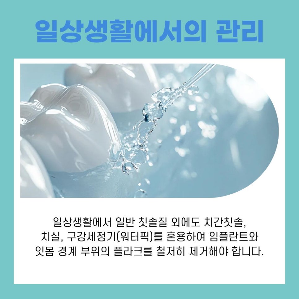 Understanding the Treatment Process at a Gangnam Station Implant Dental Clinic image 10