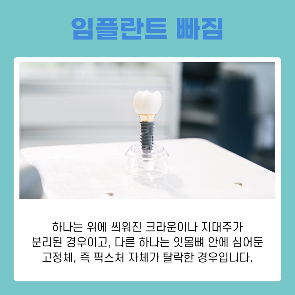 강남논현동치과 임플란트 빠짐 원인과 재치료 가능성 정리 관련 이미지 3