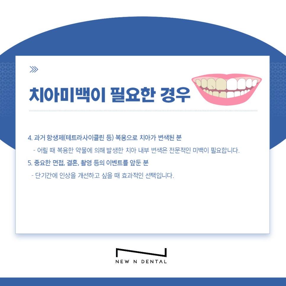 강남치과 치아미백, 누런치아 하얗게 만드는 방법은 관련 이미지 4