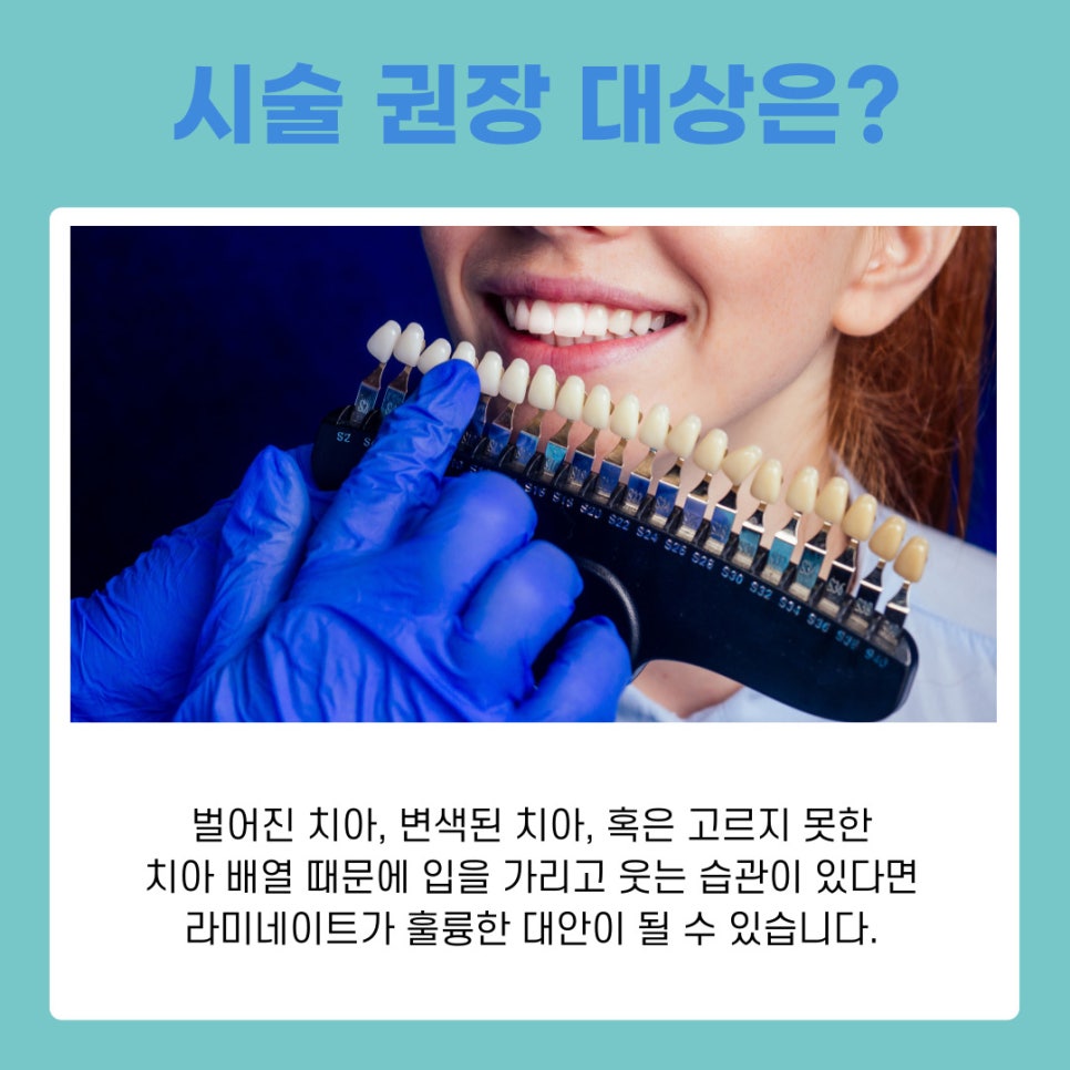 강남역 라미네이트치과 무삭제로 자연치아 지키는 법 관련 이미지 3