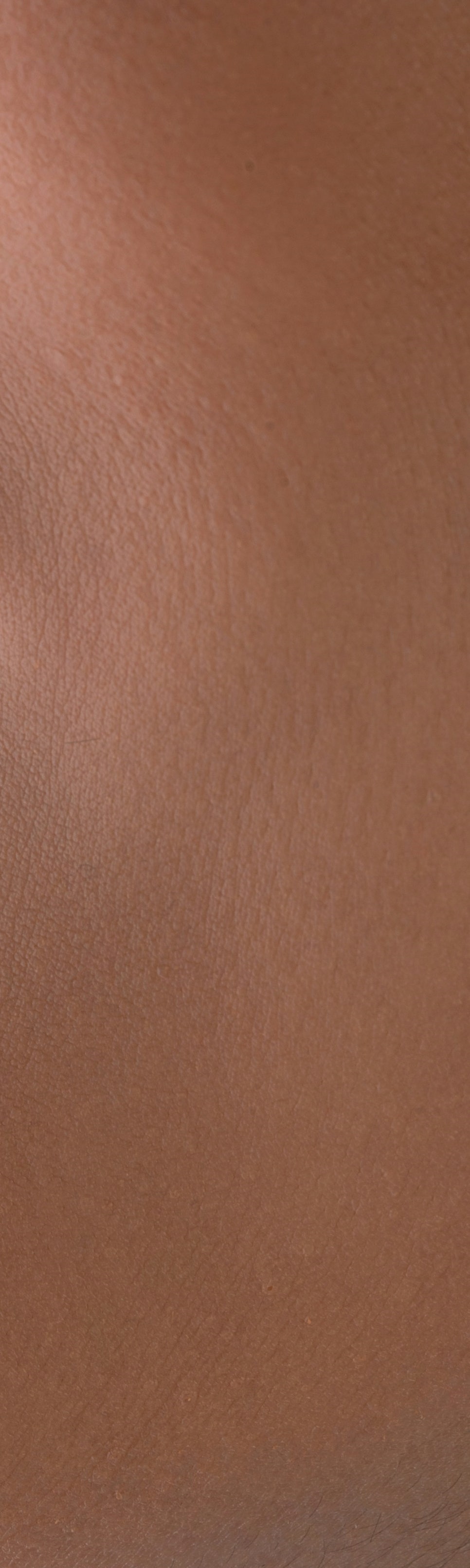 투명교정으로 치아 변화를 위해 관련 이미지 12