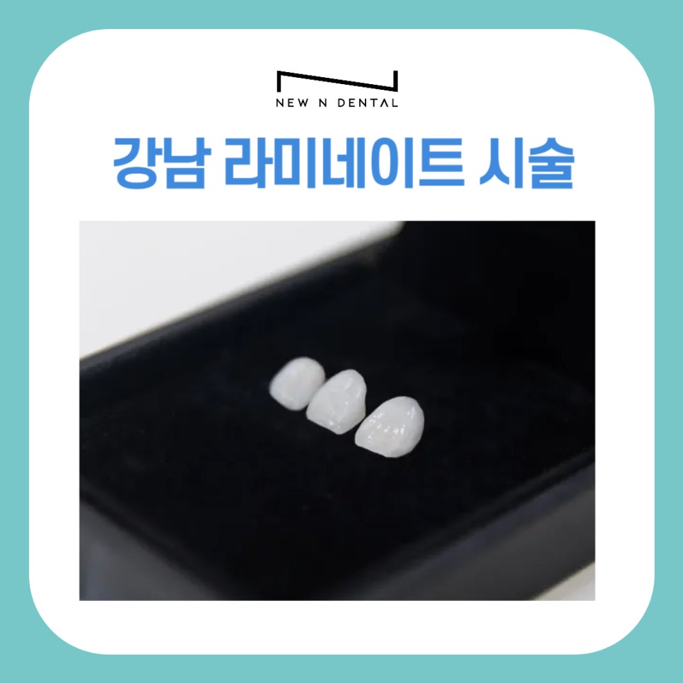 Gangnam Laminate Procedure, Natural-Looking Tooth Smile image 1