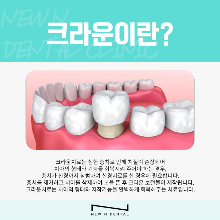 강남역충치치과 아프기 전에 미리 검진 받아야 관련 이미지 6