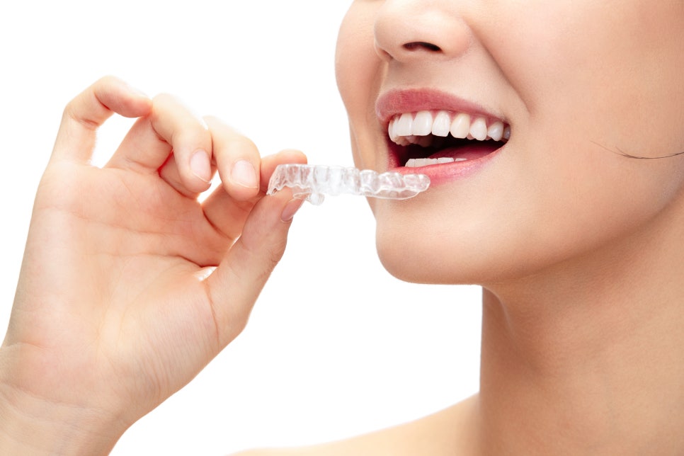 논현동치아교정치과 고른 치아를 위해서 관련 이미지 7