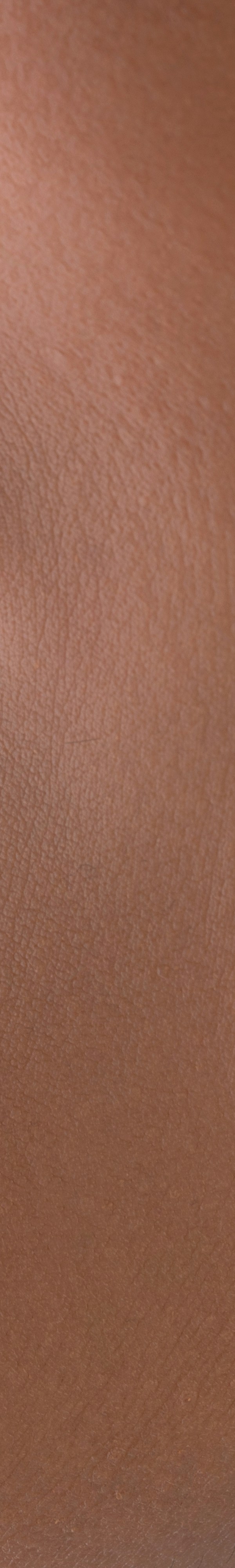 치아교정 후 유지 장치의 필요성 관련 이미지 26