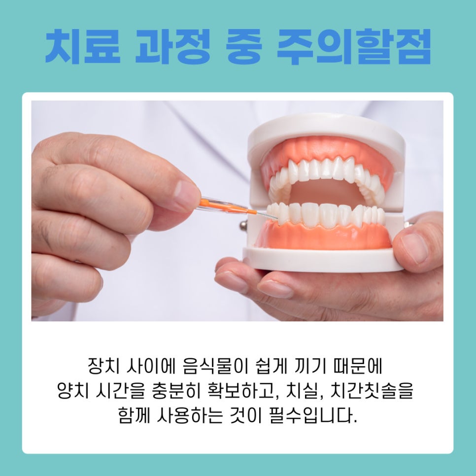 강남역교정치과 상담 받기 전 알아두면 유용한 교정 가이드 관련 이미지 7