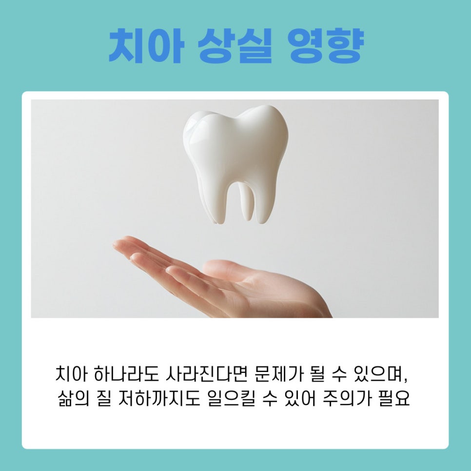 강남역치과 임플란트 시행하는 원인과 고려할 사항 관련 이미지 3