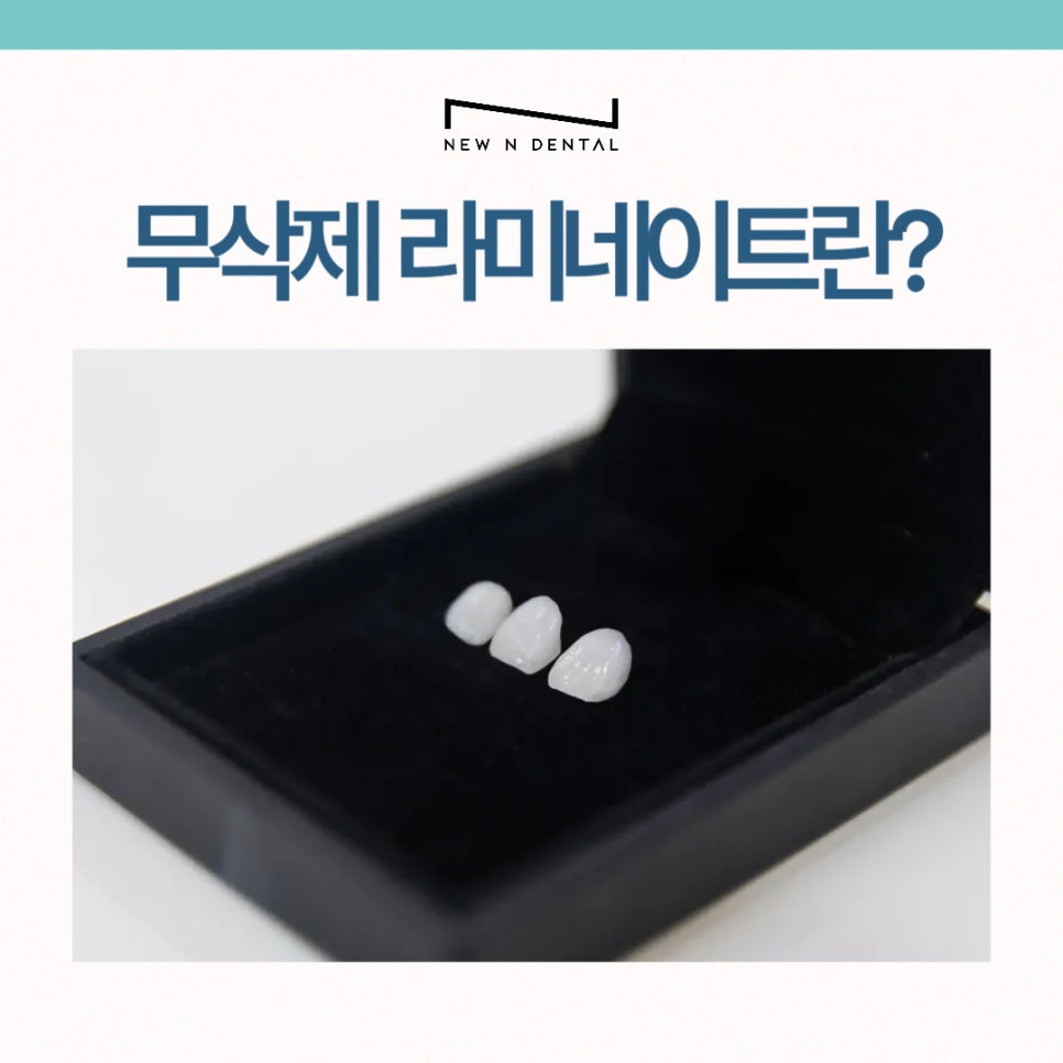 강남 무삭제라미네이트 치아깎지않는 개선방법 관련 이미지 3