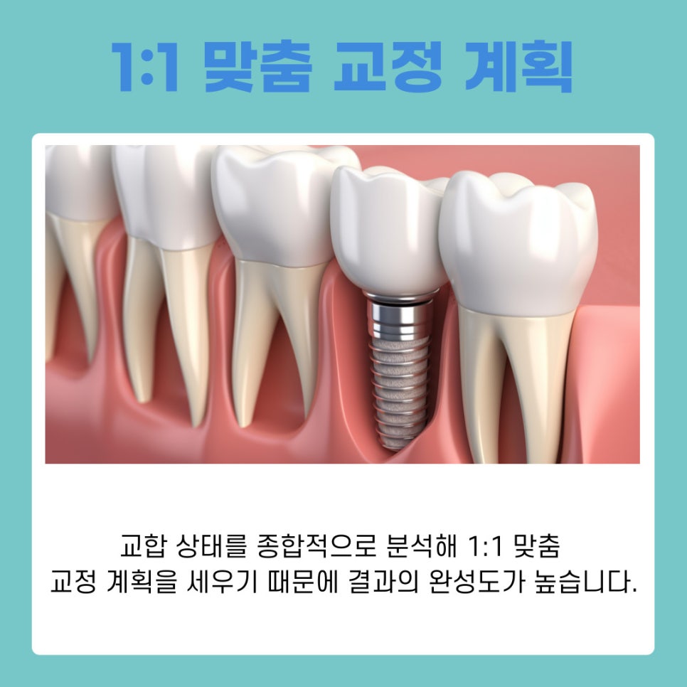 강남치아교정치과 치아교정방법, 디지털치아교정으로 더 정확하고 빠르게 관련 이미지 7