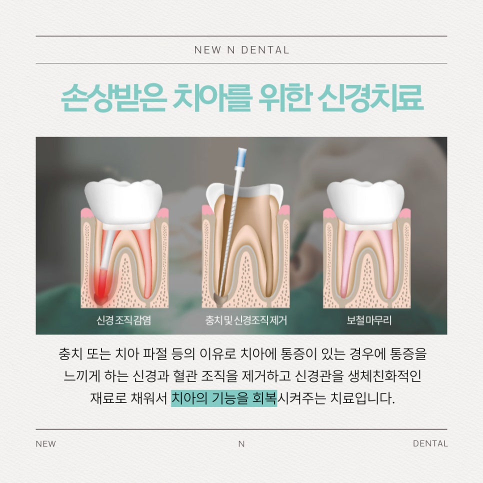 강남충치치료치과 더 늦기 전에 결정해야 관련 이미지 3