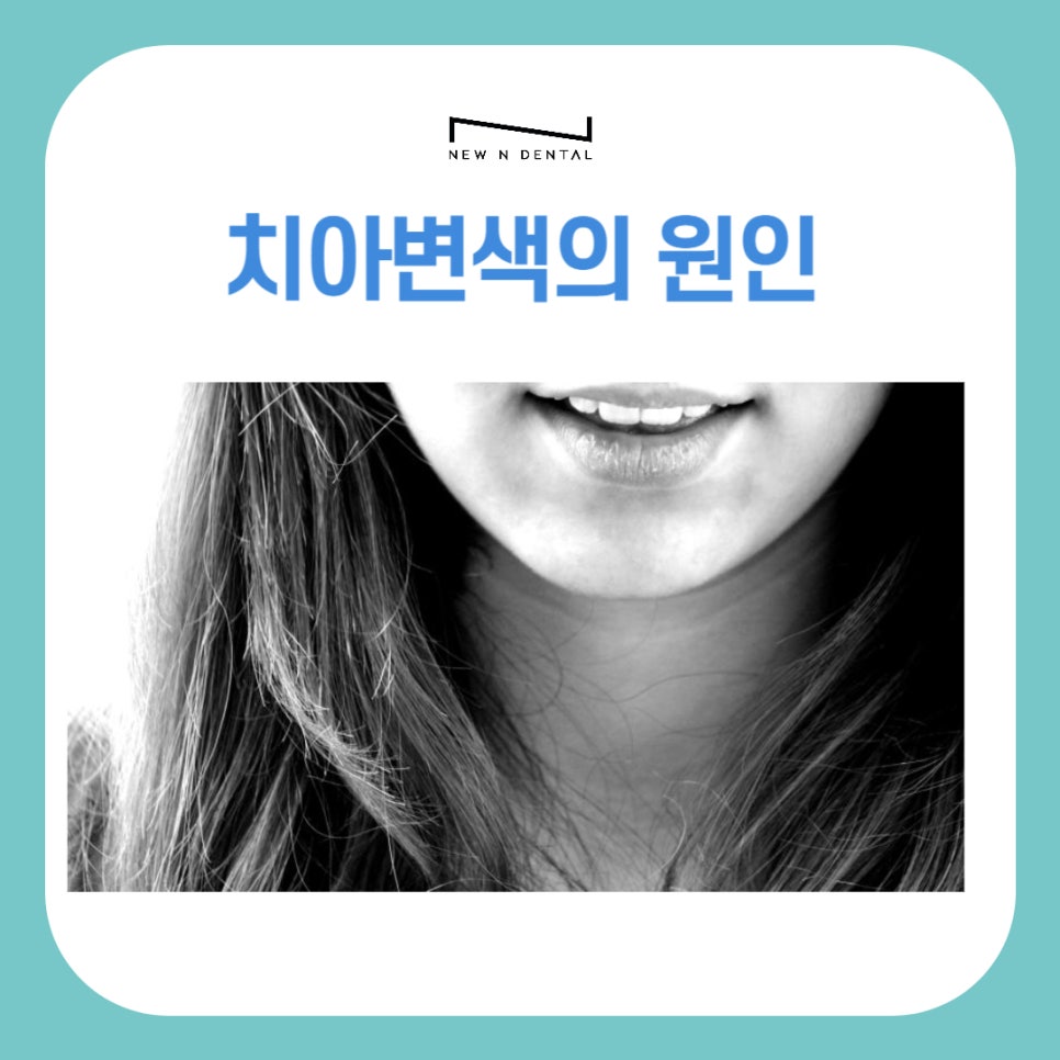 원데이 치아미백 변색의 원인과 후유증 없는 찐후기 관련 이미지 3