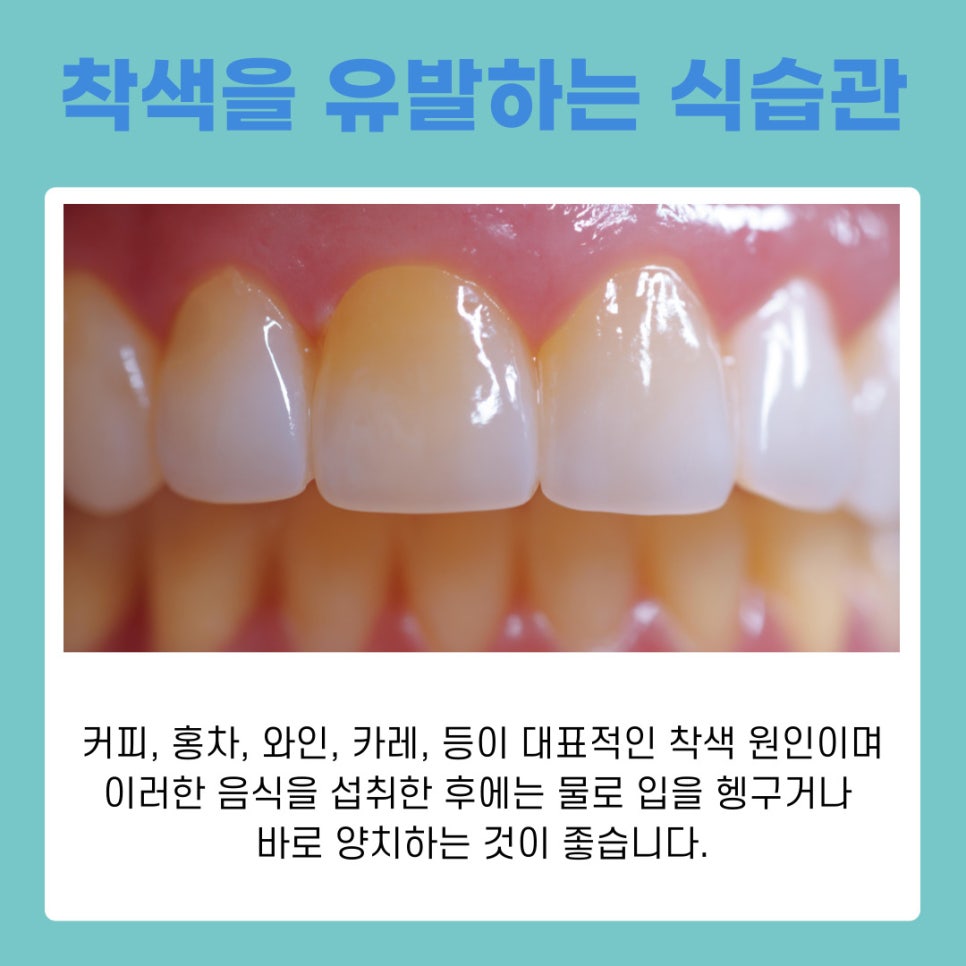 라미네이트 오래 유지하려면 알아야 할 점 관련 이미지 5