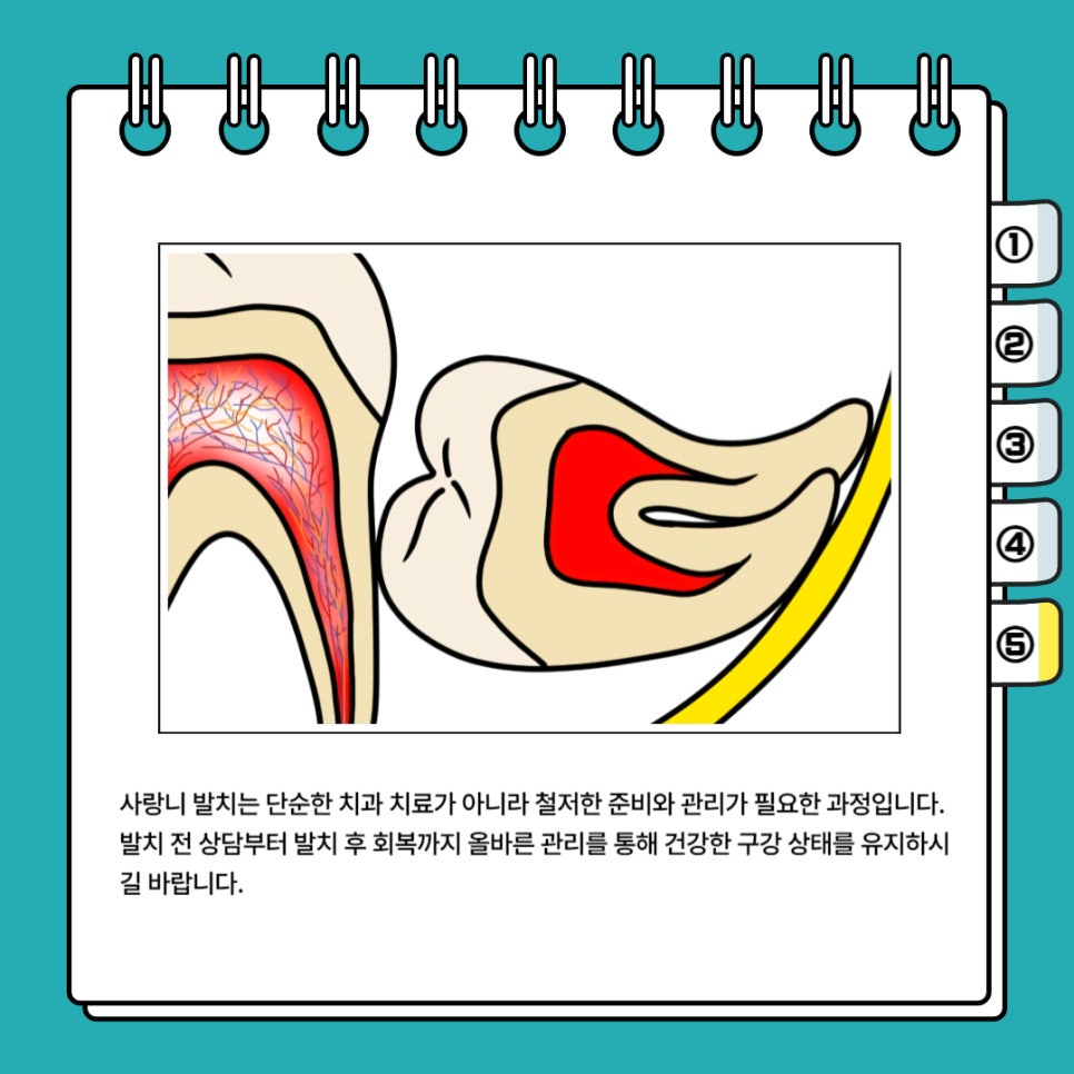 사랑니 발치 전 후 관리법 꿀팁 관련 이미지 6