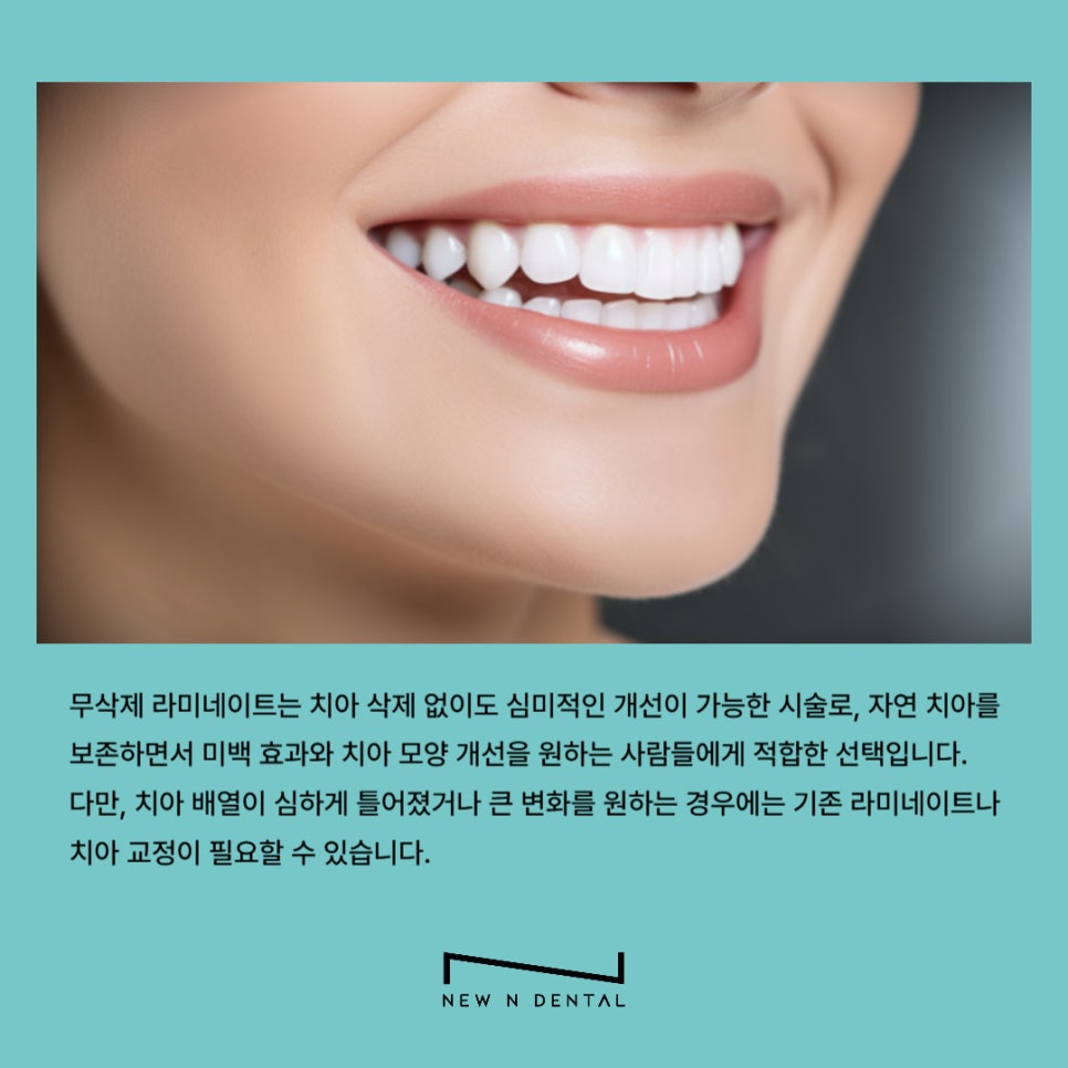 강남역치과 무삭제라미네이트 자신있게 관련 이미지 9