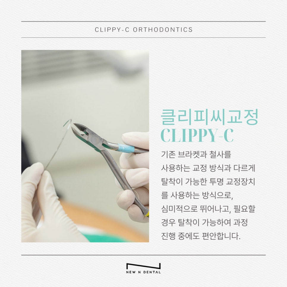 부정교합교정비용 결정 전 확인해야 할 사항 관련 이미지 9