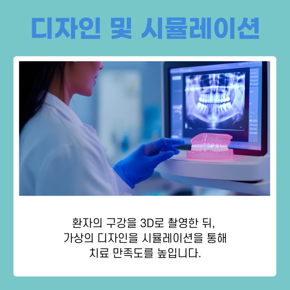강남역치과 라미네이트 방법, 단계별로 알아보기 관련 이미지 6