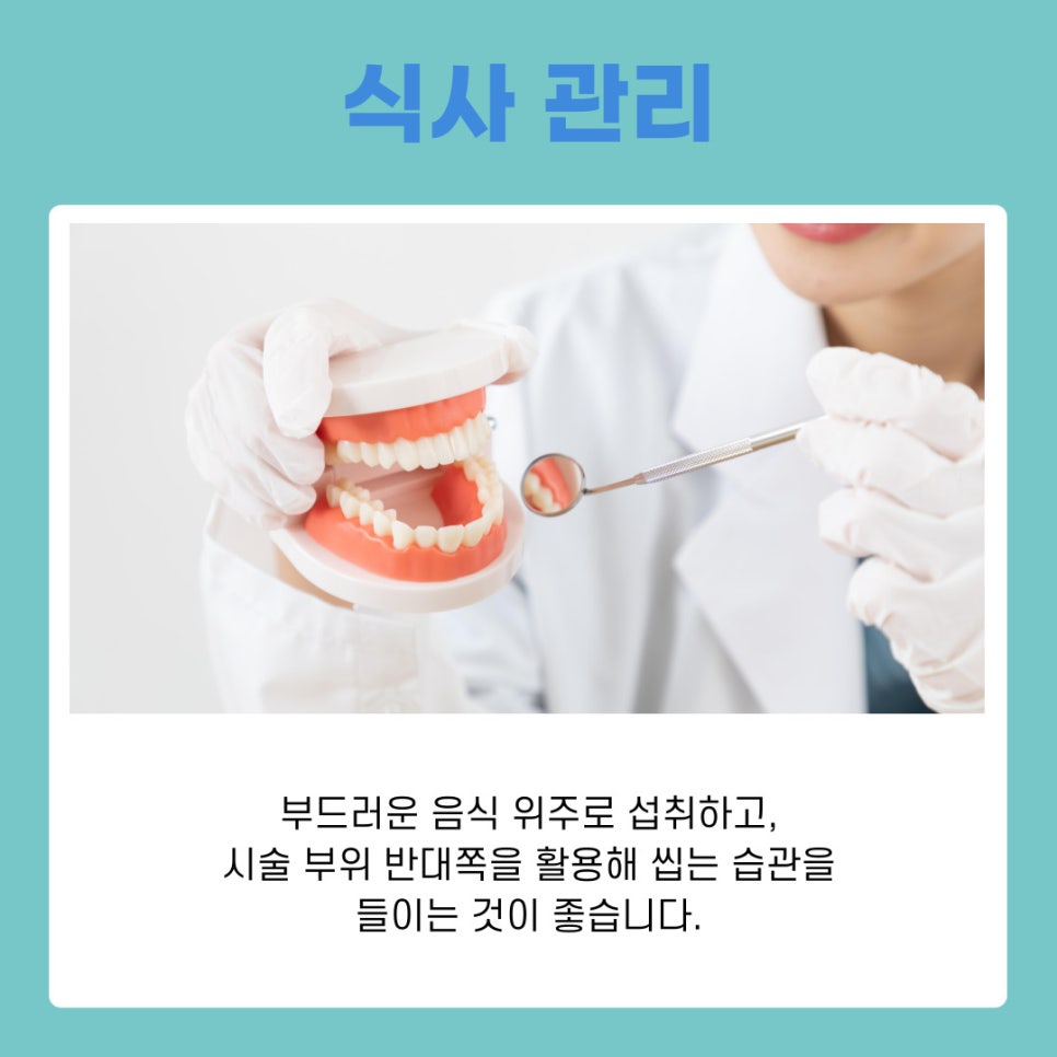 강남 논현동 임플란트 치과 주의 사항부터 시술 후 관리법까지 완벽 가이드 관련 이미지 4