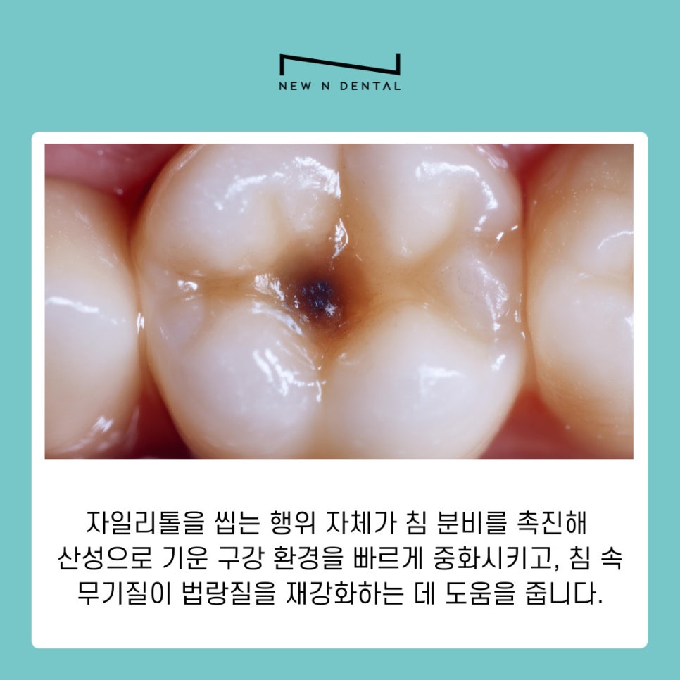 양치 후 자일리톨 정말 충치 예방에 효과 있을까 관련 이미지 5