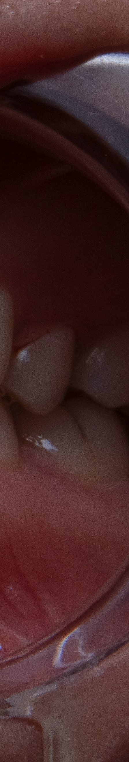 치아 미백 효과와 부작용 체크해야 할 사항 관련 이미지 26