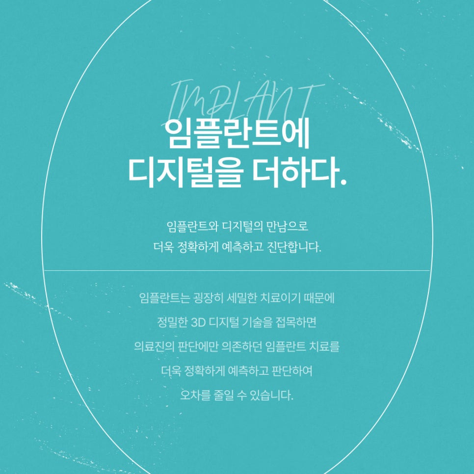 임플란트수술비용과 치료 과정에 대한 정보 관련 이미지 2